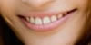 Sourire